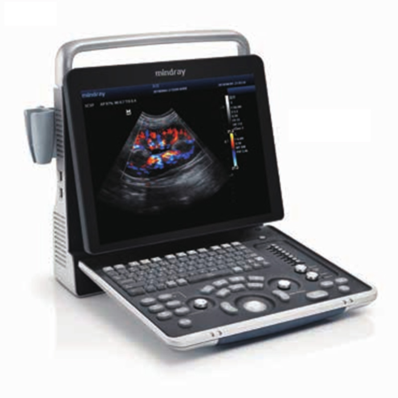 Mindray Z60 High Performance Laptop Ultrasound System