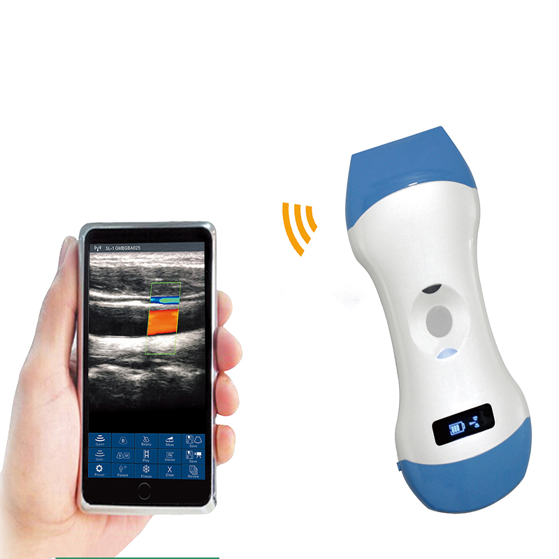 Amain ultrasound portable wireless MagiQ CW5D multifunction 2d echo palm ultrasound ທີ່ມີ 128 ອົງປະກອບ B/W Imaging
