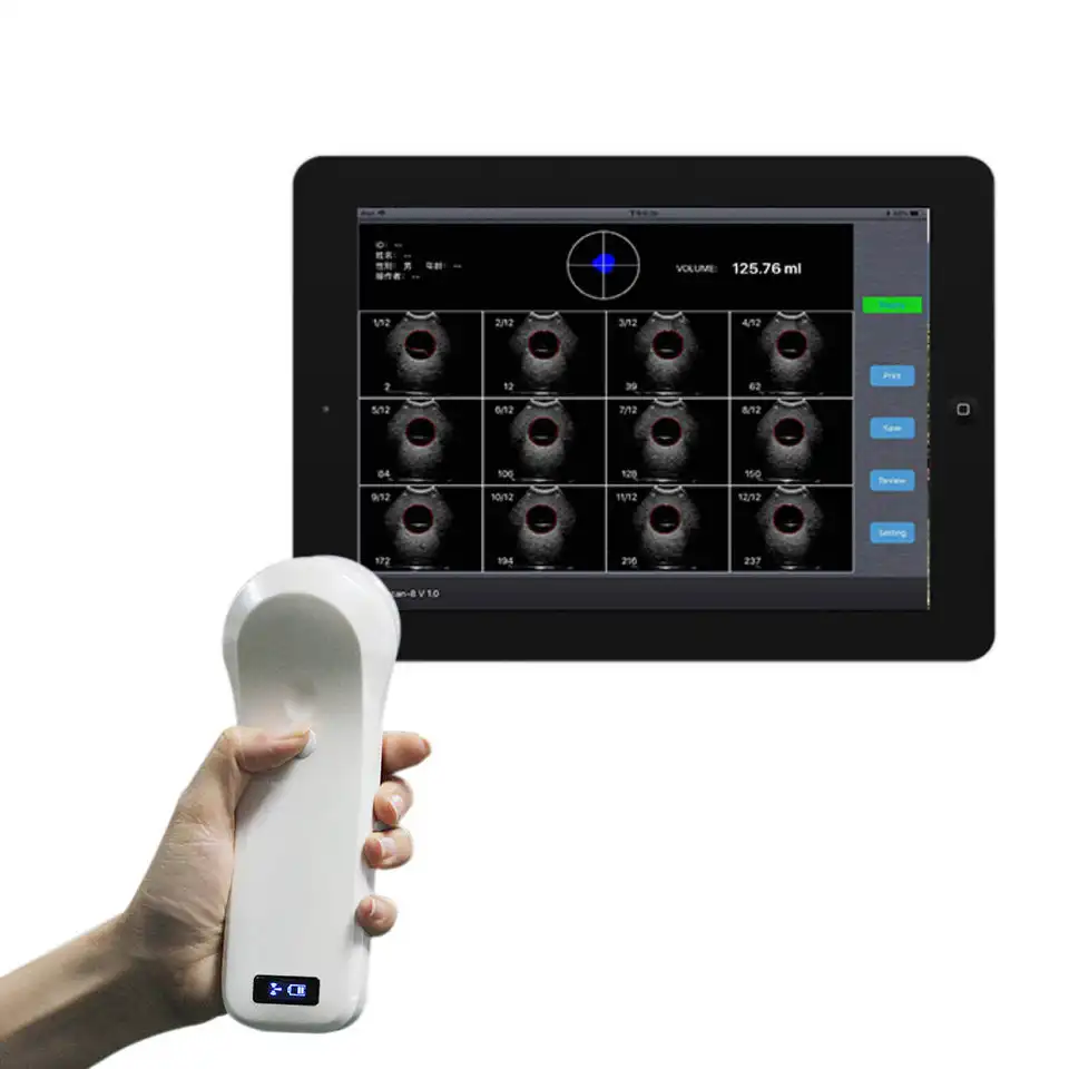 Wireless Mini Ultrasound Probe Medical Ultrasound Diagnostic Equipment 4D Wireless Portable Mini Ultrasound Bladder Probe
