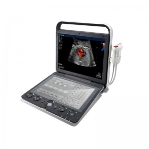 SonoScape S9 Pae-rite Ophthalmology Pūrere Ultrasound