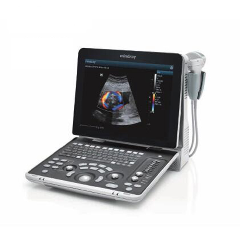 Ergonomic Design for Linear and Convex Mindray Z50 Ultrasound Device with Rechargeable Battery