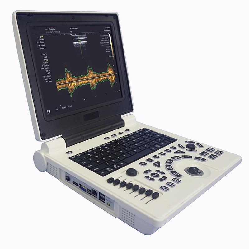 Amain P20 Notebook Ultrasonic Diagnostic System Hospital Diagnostic Equipment Laptop BW ultrasound with PW function Good Price