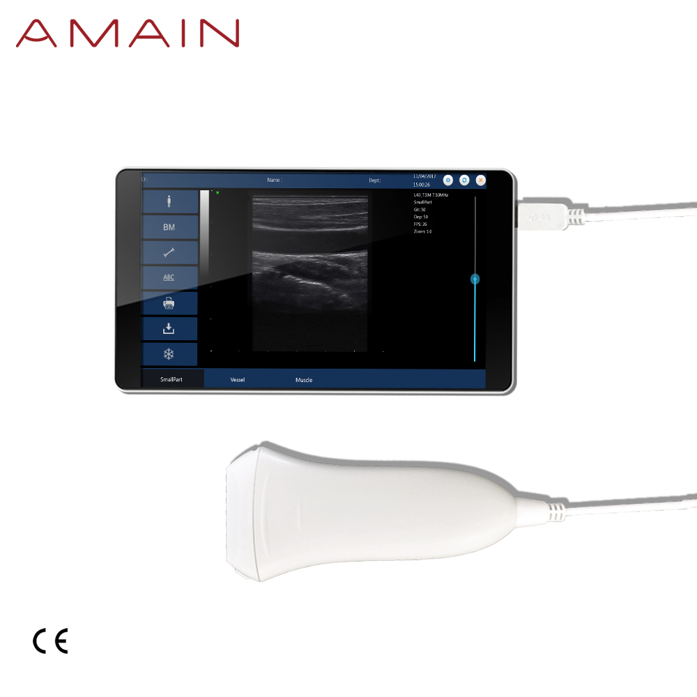 Big Discount Ent Treating Desk - Amain MagiQ 2L Fast Diagnosis Ultrasound Equipment – Amain