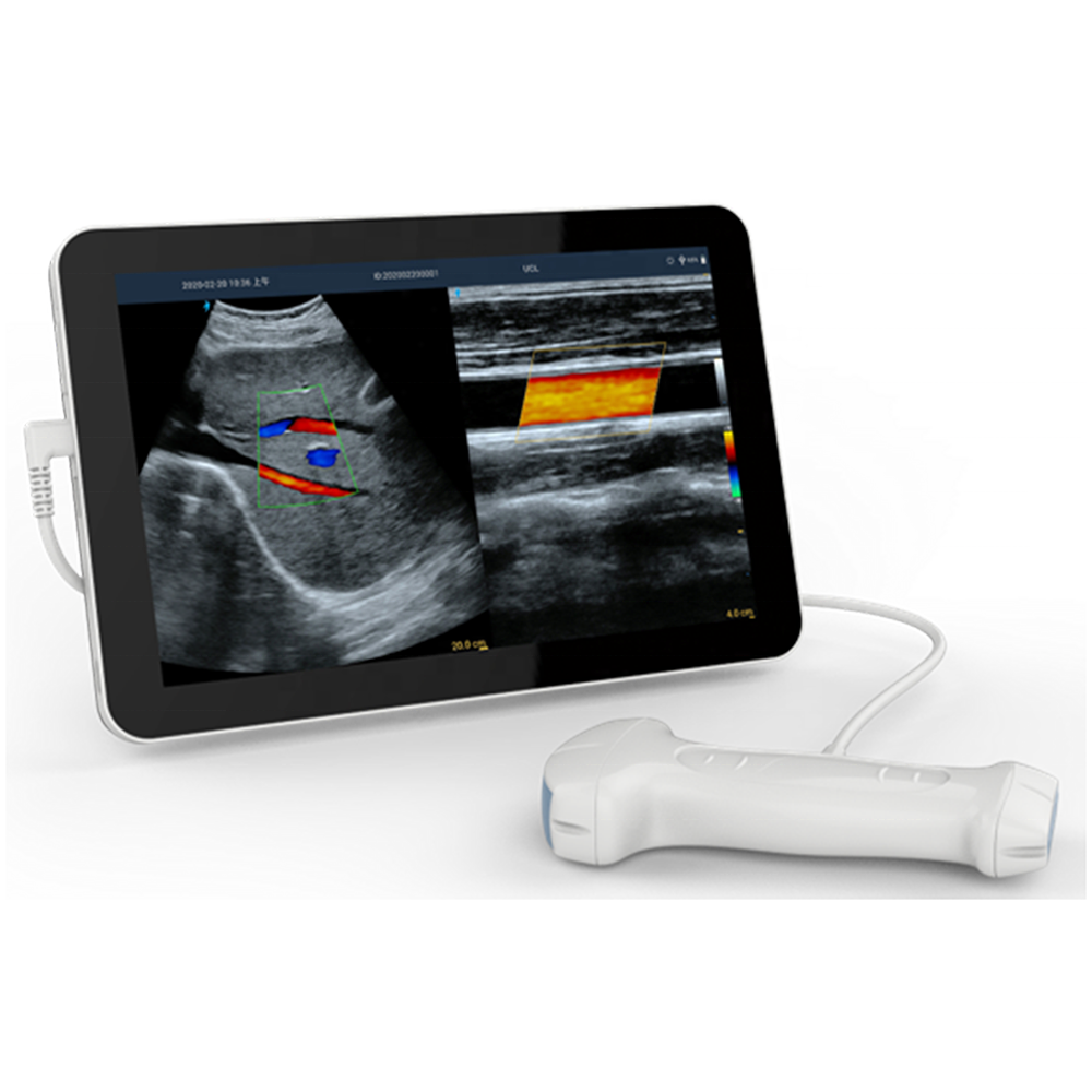 Amain MagiQ MCUCL Manufacture price of Pregnancy Ultrasound Machine Linear & Convex Dual Probe Android Ultrasound Scanner