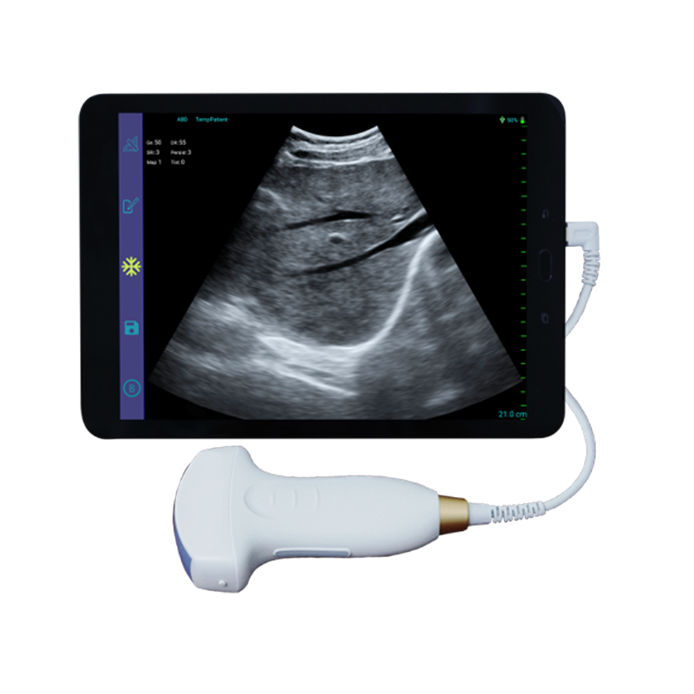 Escáner de ultrasóns doppler de cor Amain MagiQ MCUC5-2E con certificado CE Sonda lineal curva para escaneo rápido