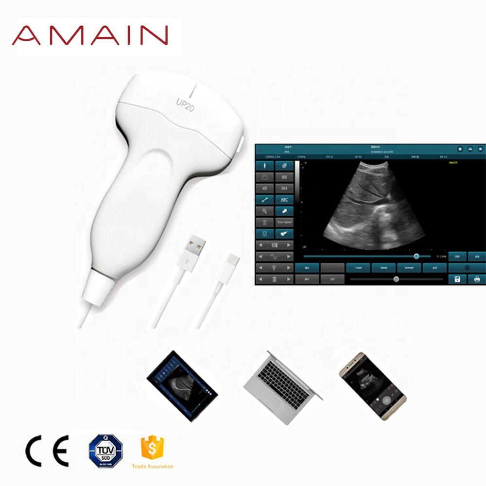 Sistema ta 'ultrasound portabbli konvessa ta' AMAIN Sistema ta 'ultrasound mediku li jinżamm fl-idejn l-istess bħal CHISON P1/ lumify / vscan / konted