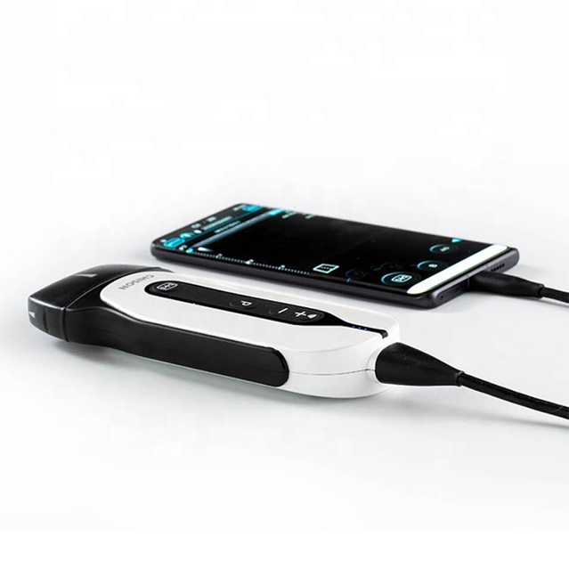 CHISON SonoEye P2 Lineer Renkli Doppler Mini Satılık Yüksek Çözünürlüklü Taşınabilir USB Ultrason Tarayıcı