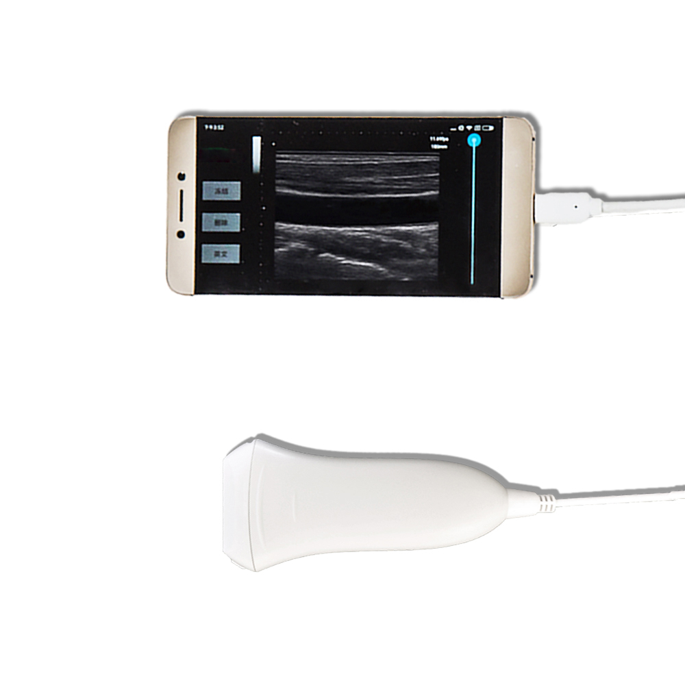 Amain MagiQ 2L Smart Portable Diagnostics Ultrasound