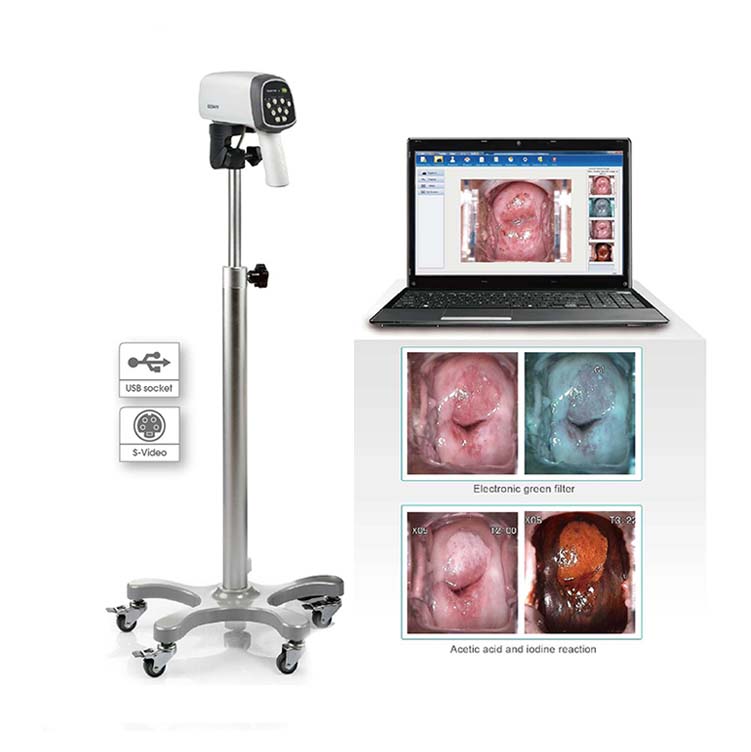 Vaginal Colposcope for Gynecology Double Diaphragm