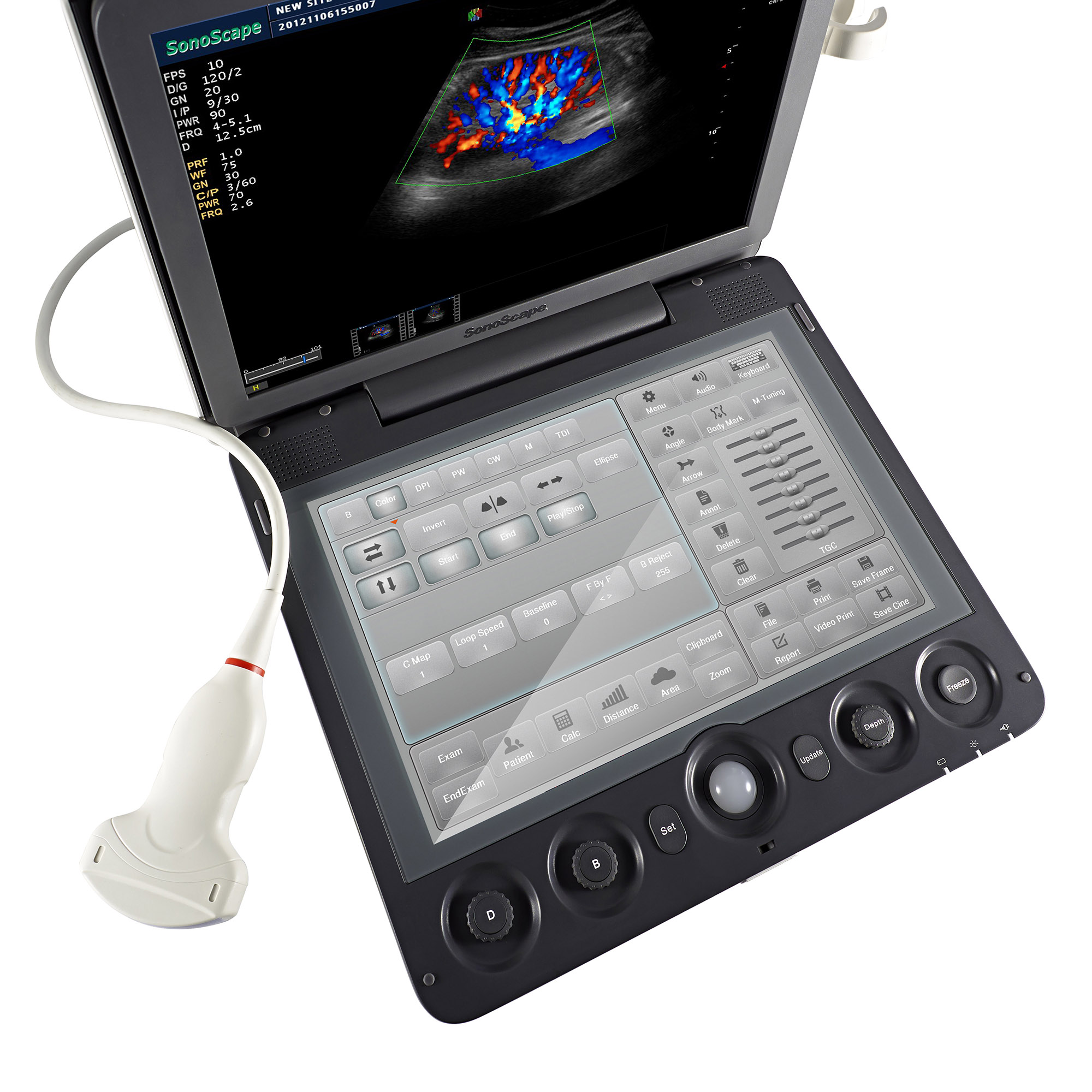 Amain Sonoscape S9 4D touch screen color doppler medical ultrasound
