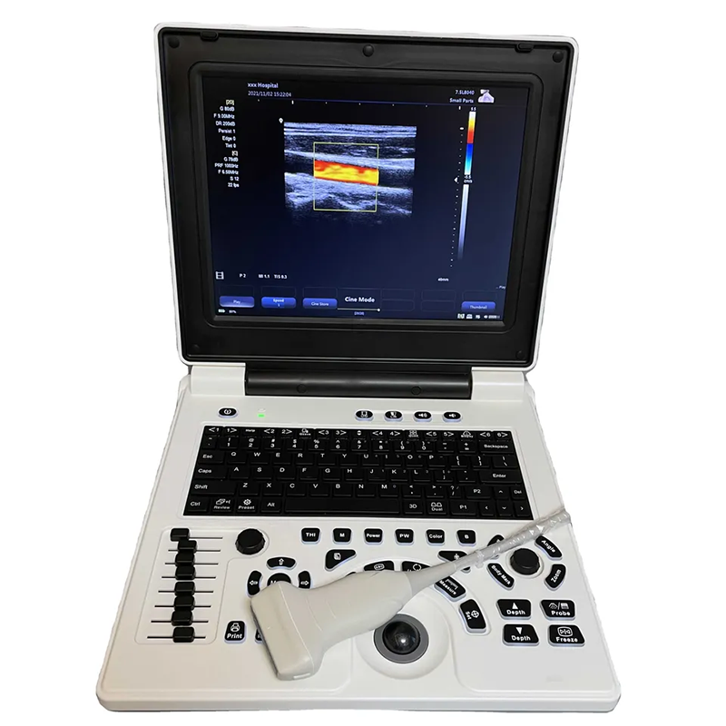 Amain E20 Laptop 4D Color Doppler Ultrasound Scanner Medical Portable Ultrasound Scanner For Human Use Price