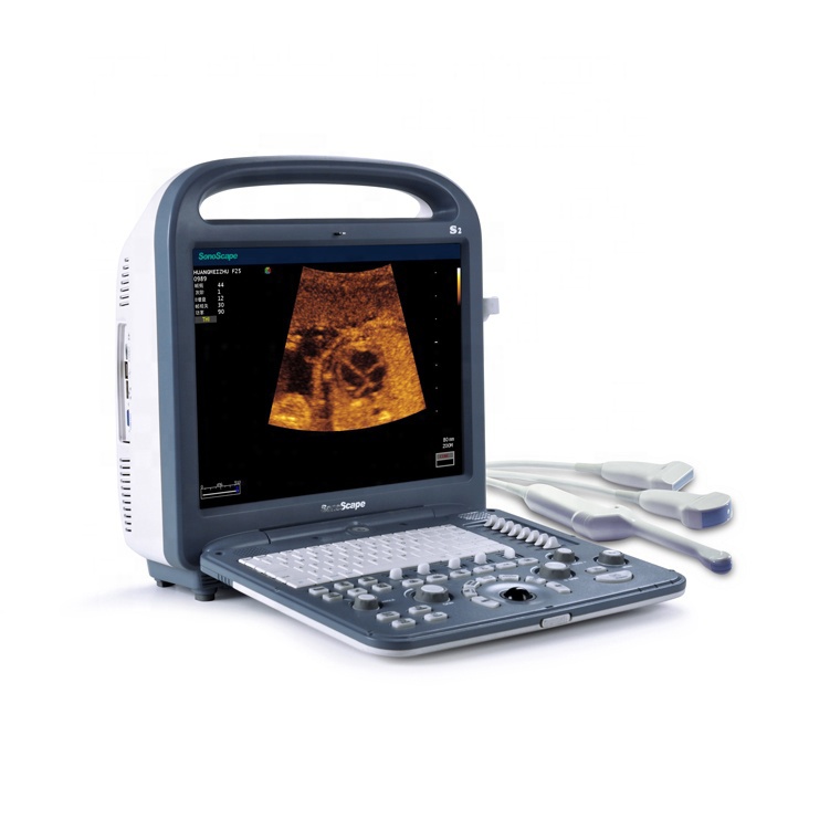 Teşhis Kullanımı İçin SonoScape S2 3D / 4D Renkli Dijital Taşınabilir Dizüstü Ultrason Makinesi