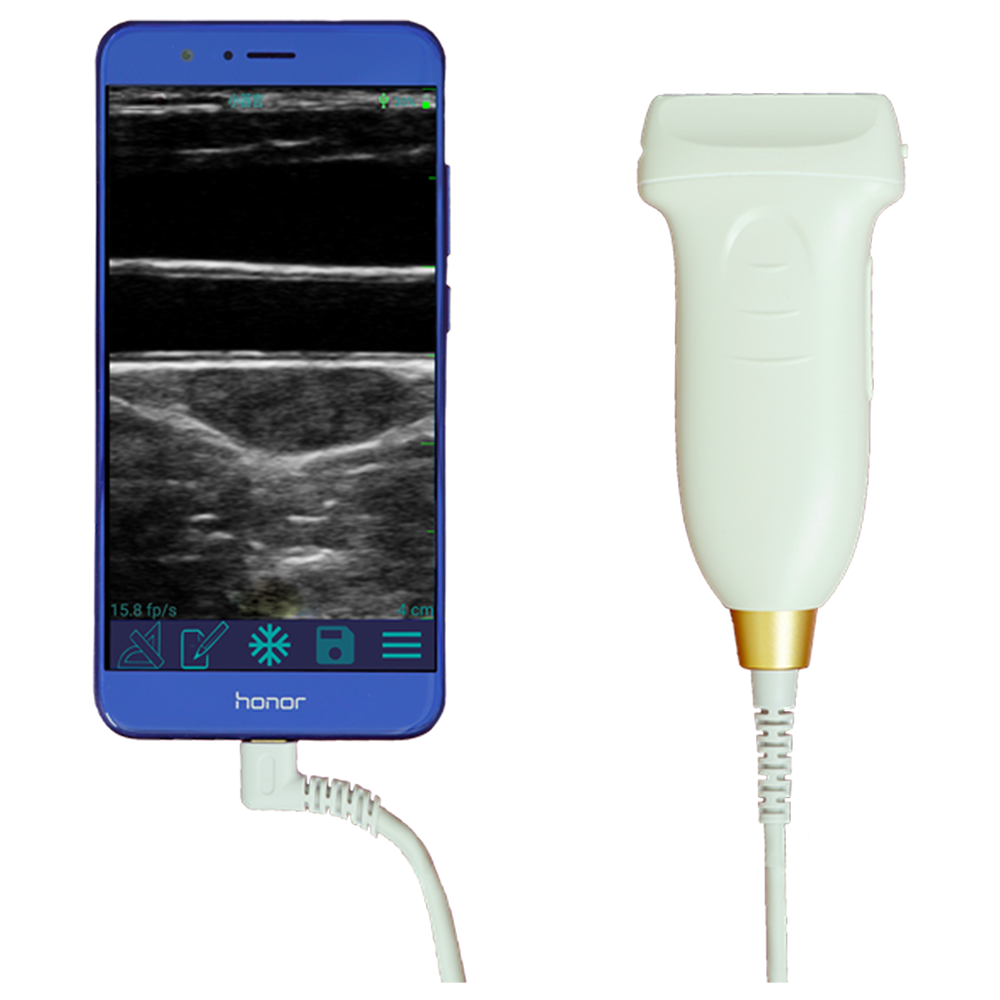 Amain MagiQ MPUL10-5E the economical Black and White  Linear probe with cost-effective medical supplies for ultrasound scanning