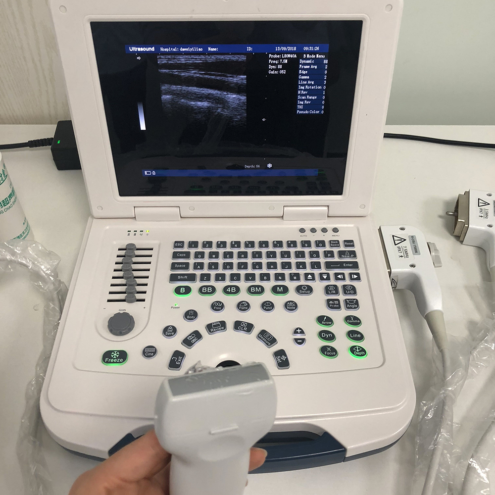 Amain AMDV600 ultrasound manufacturers portable B/W ultrasound machine with linear convex and cardiac probe for OB GYN and heart