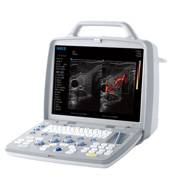 SIUI CTS 8800Plus Ultrason CTS 8800Plus Tıbbi Ultrason Teşhis Sistemi Taşınabilir Ultrason Tarayıcı Ucuz Fiyat