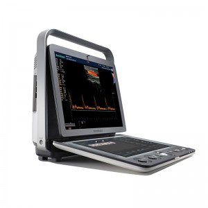SonoScape S9 Urubuga-rite Ophthalmology Igikoresho cya Ultrasound