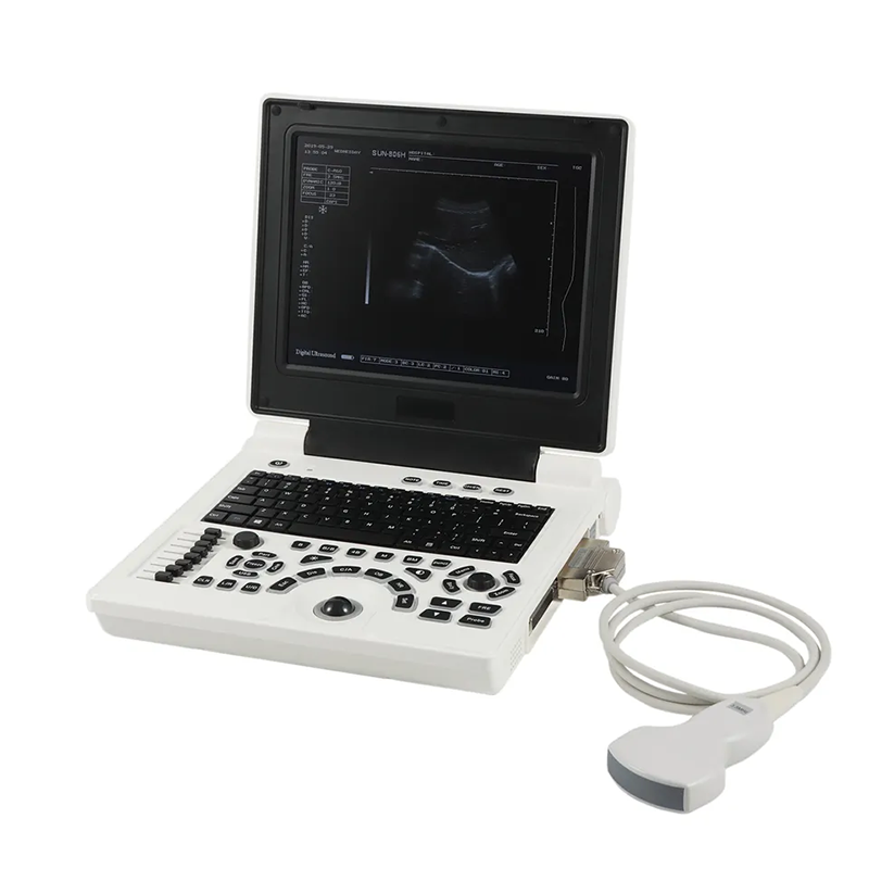 Cheapest Laptop Portable B/W Ultrasound Cheapest Portable Ultrasound Machine