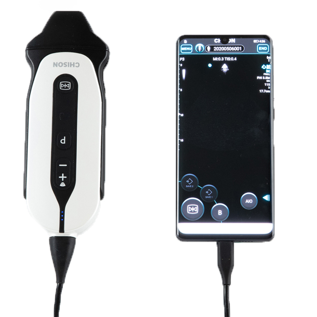 Chison SonoEye P3 Mobile Diagnostic Phased Array Ultrasound