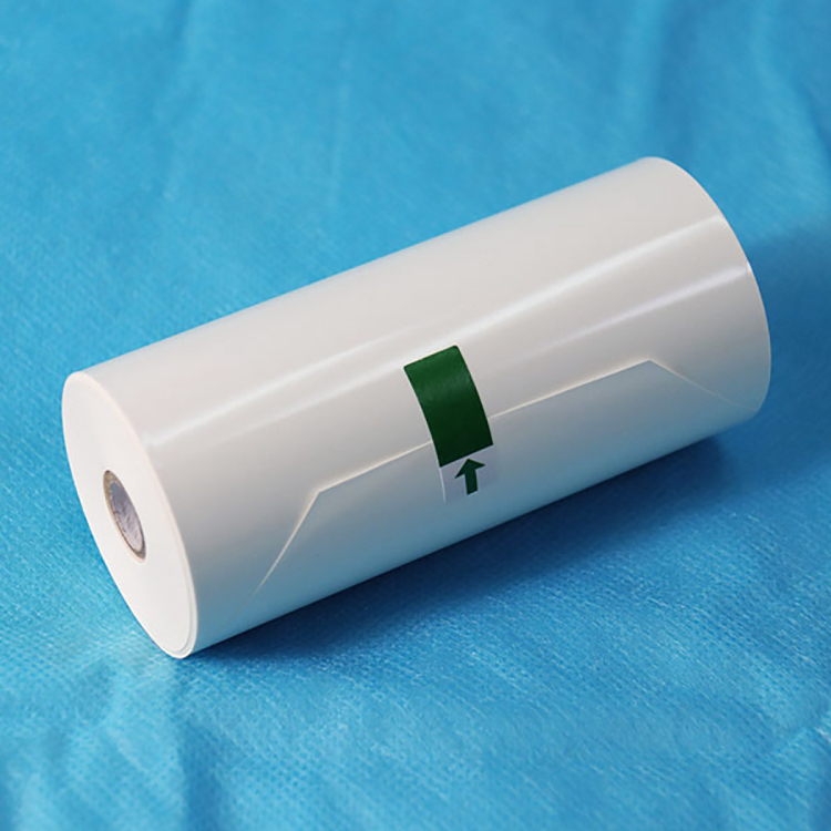 Tip V Yüksek Parlak Sony Ultrason Yazıcı Kağıt Rulosu Tıbbi Ultrason Termal Kağıt