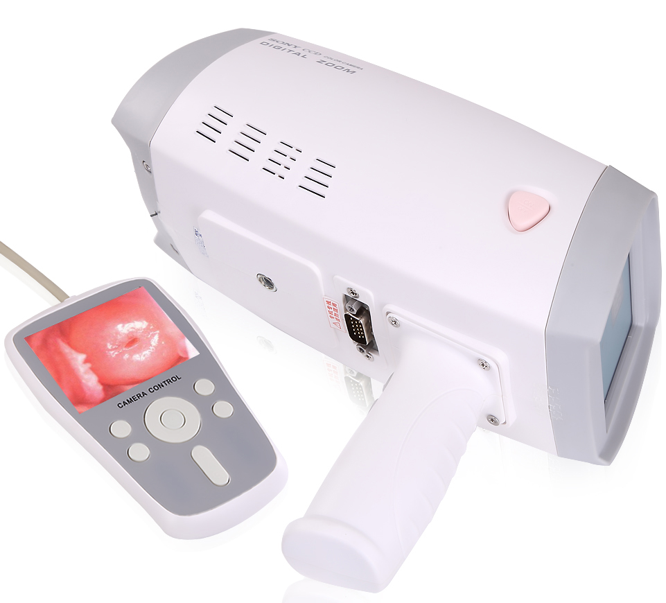 Portable Vagina Video Gynecology Colposcope Camera Scope Gynecological