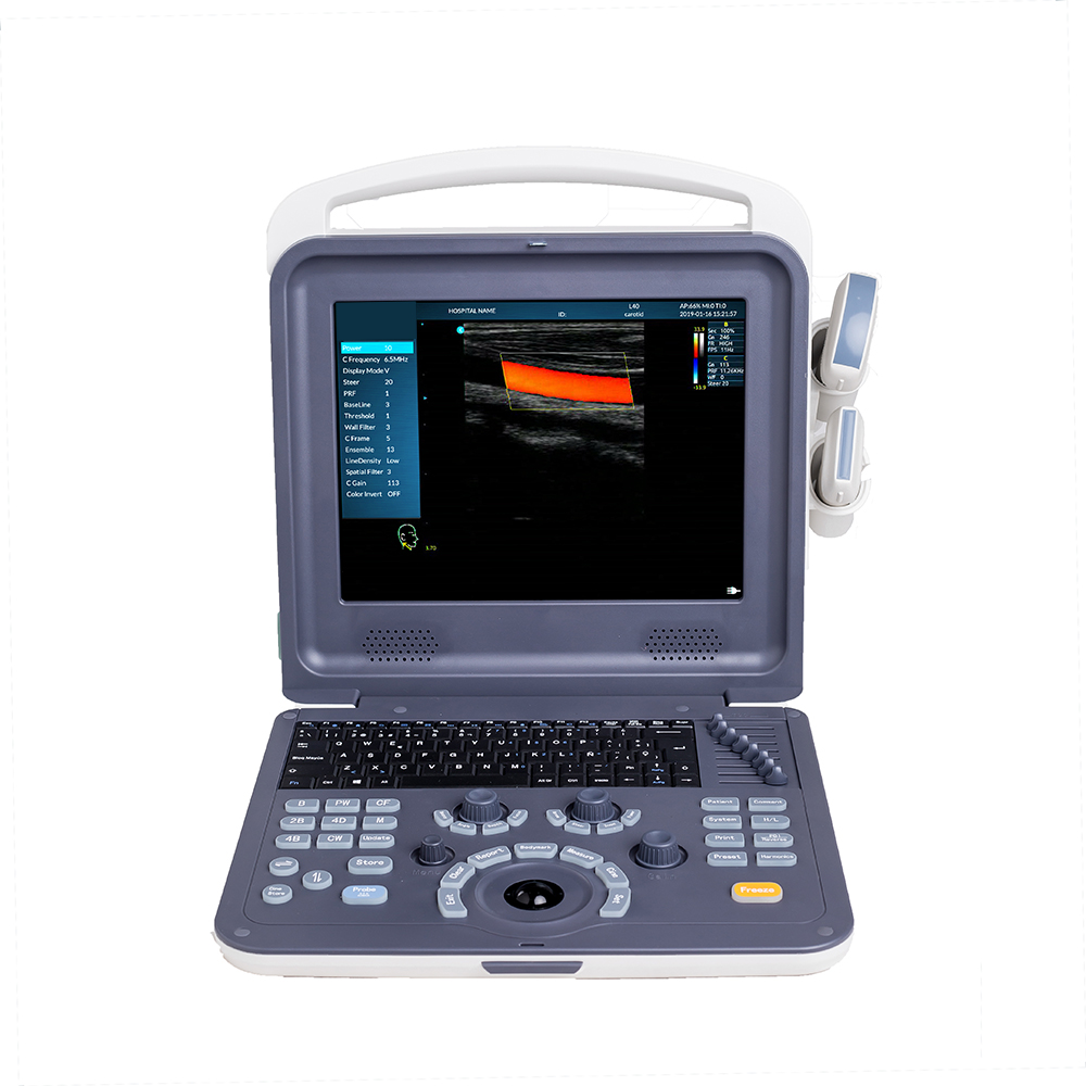 Amain Low Price Clinic Portable Ultrasound Machine with CE/ISO Certificate from China ultrasound machine for hospital