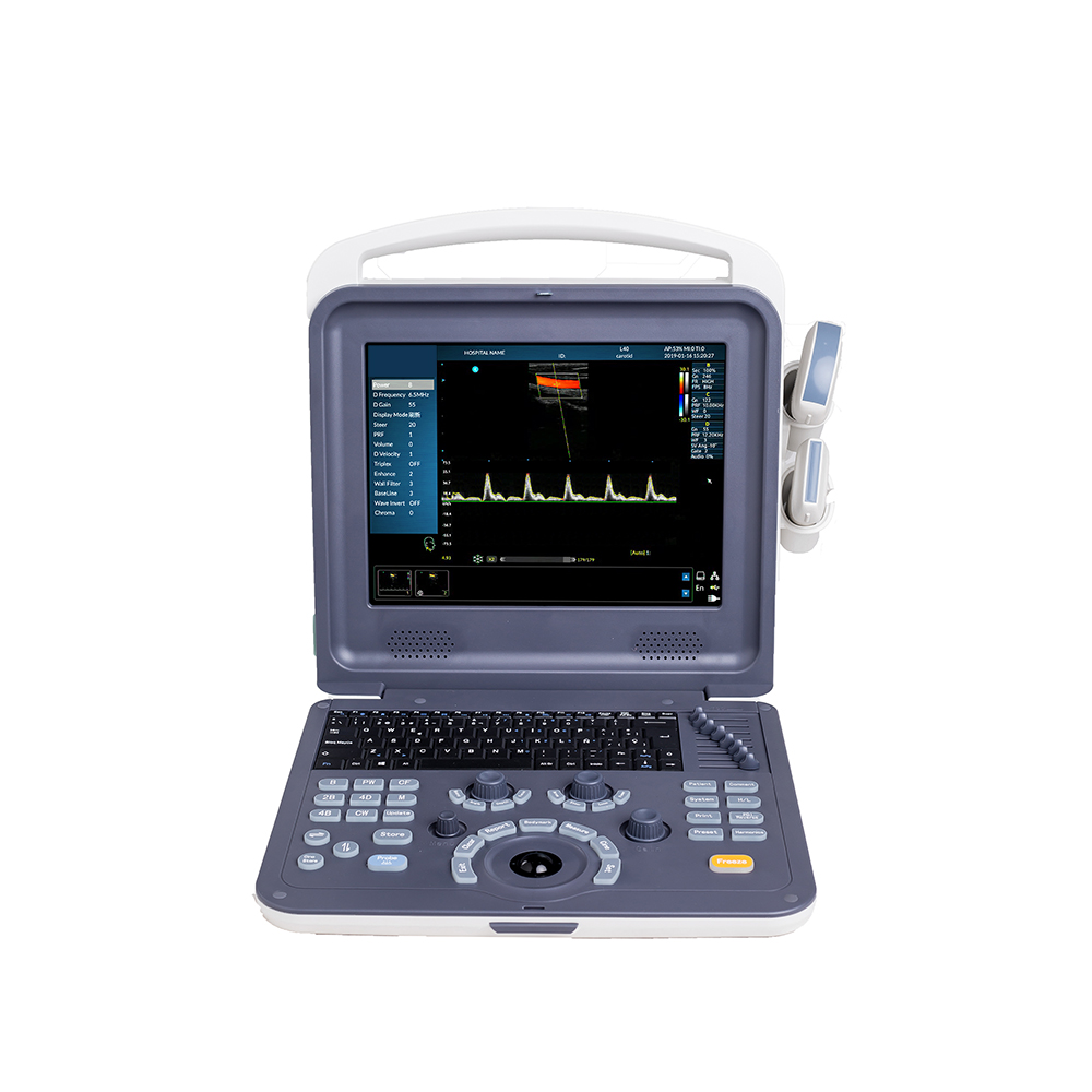 AMAIN Find C0 Basic Laptop ultrasound color doppler system for OB GYN MSK emergency medical diagnosis device equipment