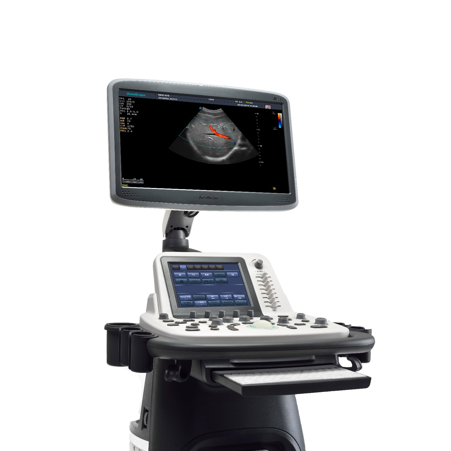 Klinik Uygulama için SonoScape S22 Dijital Dizüstü Ultrason Dönüştürücü WIFI Bağlantı Makinesi