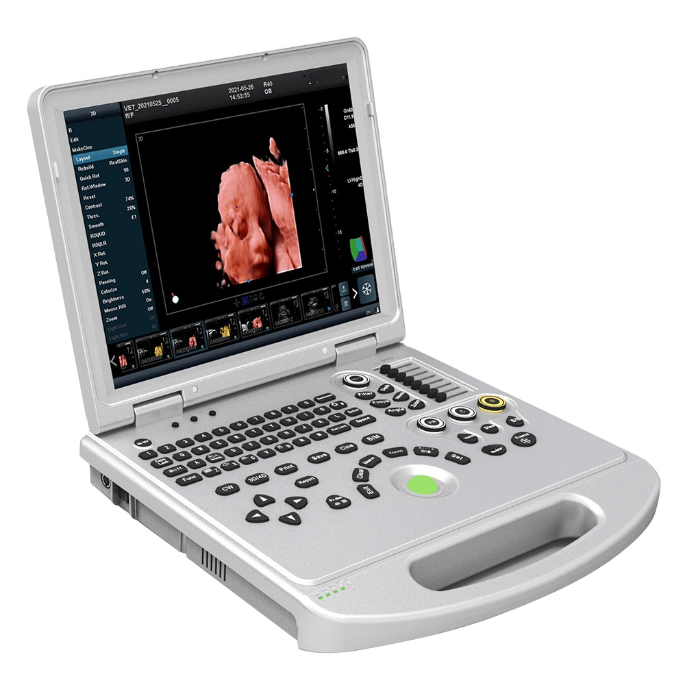 Amain OEM/ODM Manufacturers The new upgrade AMDV- L5 Pro color doppler 3D/4D/5D ultrasonic medicine with  full digital 5D laptop