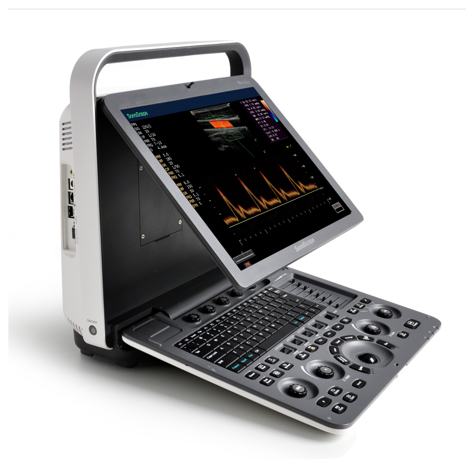 SonoScape S8 Exp Hand Carried Clinic Use Mobile Ultrasound Scanner With THI/CFM/PDI Function