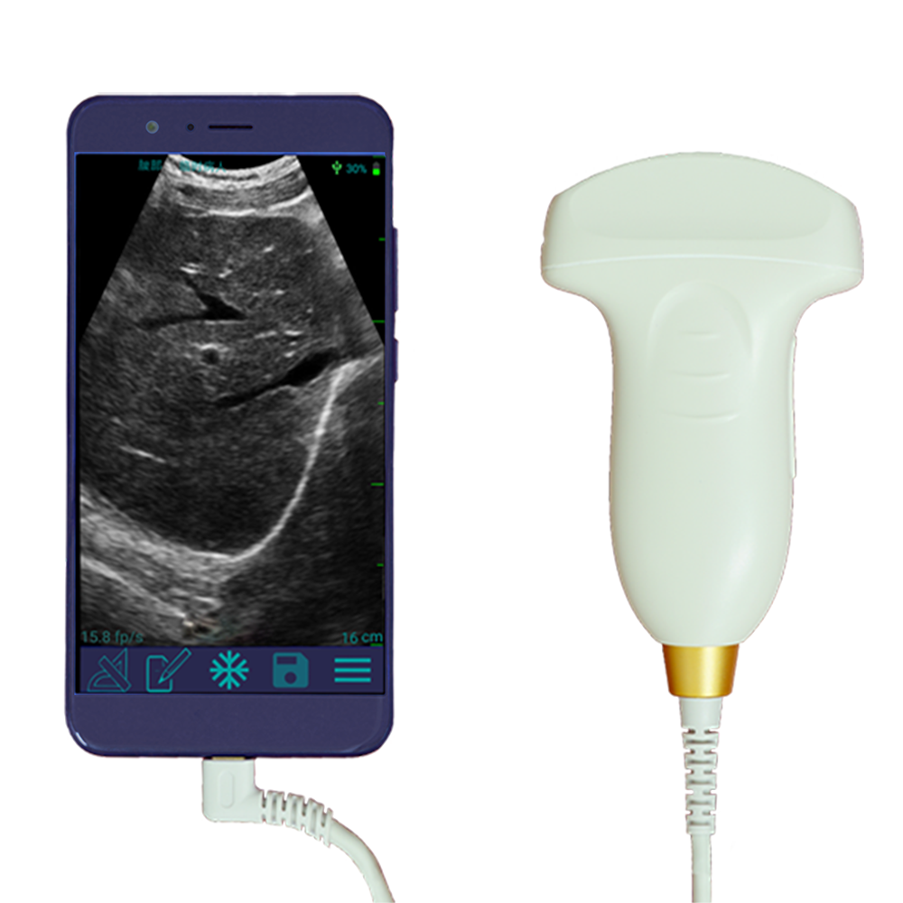 China wholesale Medical Ultrasound - Amain MagiQ MPUC 5-2 Black and White Convex Palm Vascular Endoscopic Ultrasound GE Facility Ultrasound Probe – Amain
