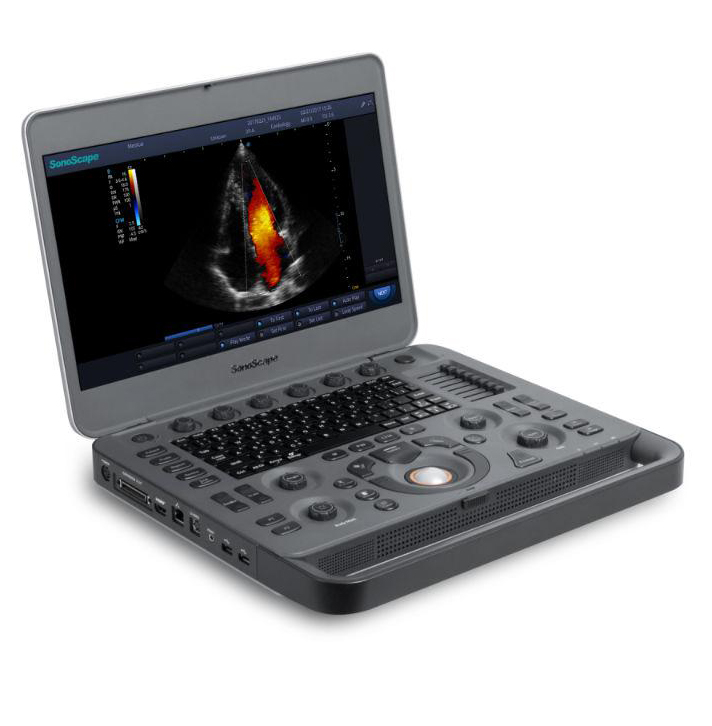 SonoScape Serisi Ultrasonik Teşhis Elde Taşınabilir Veterinerlik Dizüstü Bilgisayarı X5/X3 Ultrason Makinesi