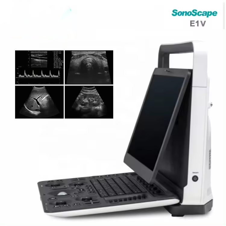 Sonoscape veterinary ultrasound machine e1v for vet color doppler animal portable ultrasound machine