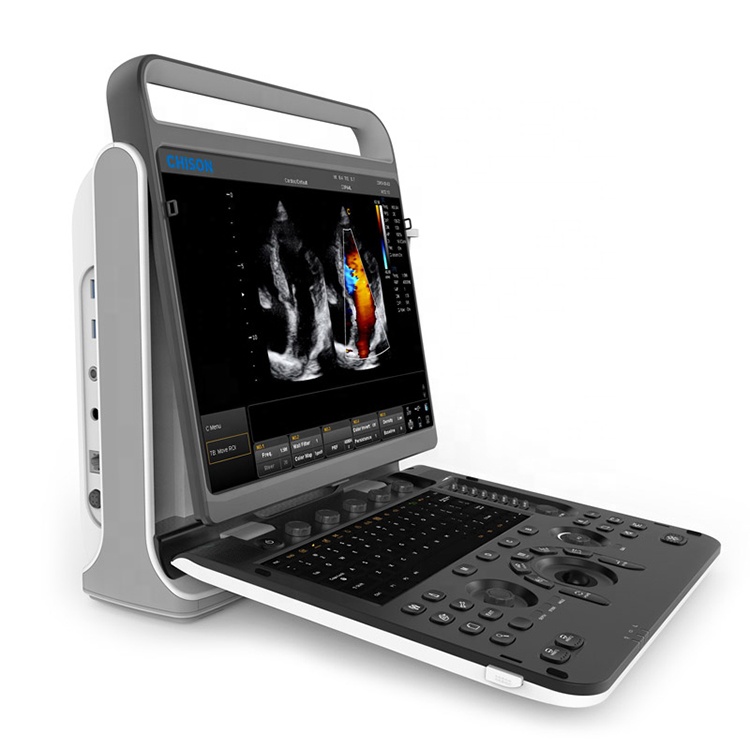 Laptop Ultrasound Machine CHISON EBit 60 4D Probe Siterite Color Doppler Medical Instrument cardiac ultrasound machine