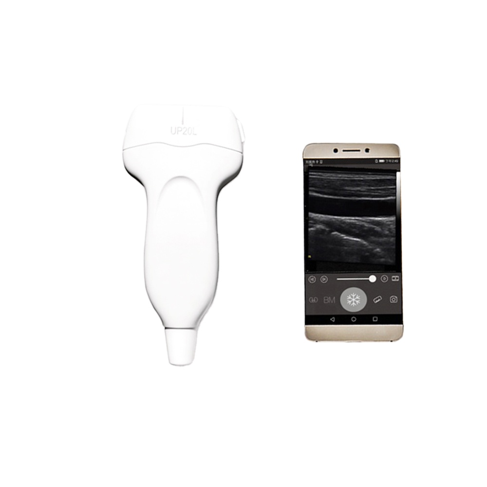 Mobile POCUS Black and White HD Linear Amain MagiQ 2L lite USB Medizinisches Ultraschall-Handheld-Ultraschallsystem Healson