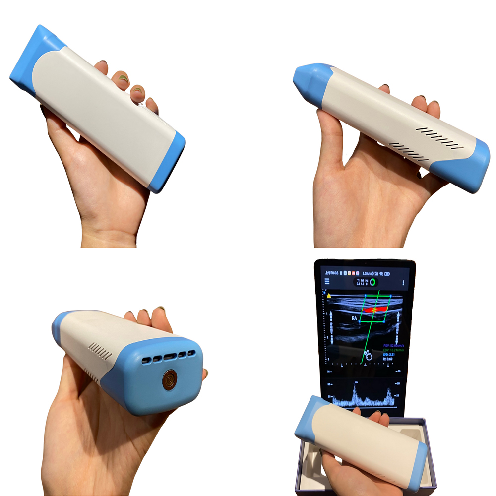 Amain MagiQ HL Pro Kablosuz Renkli Doppler Ultrason Tarayıcı En Yüksek Maliyetli Taşınabilir Ultrason Cihazı