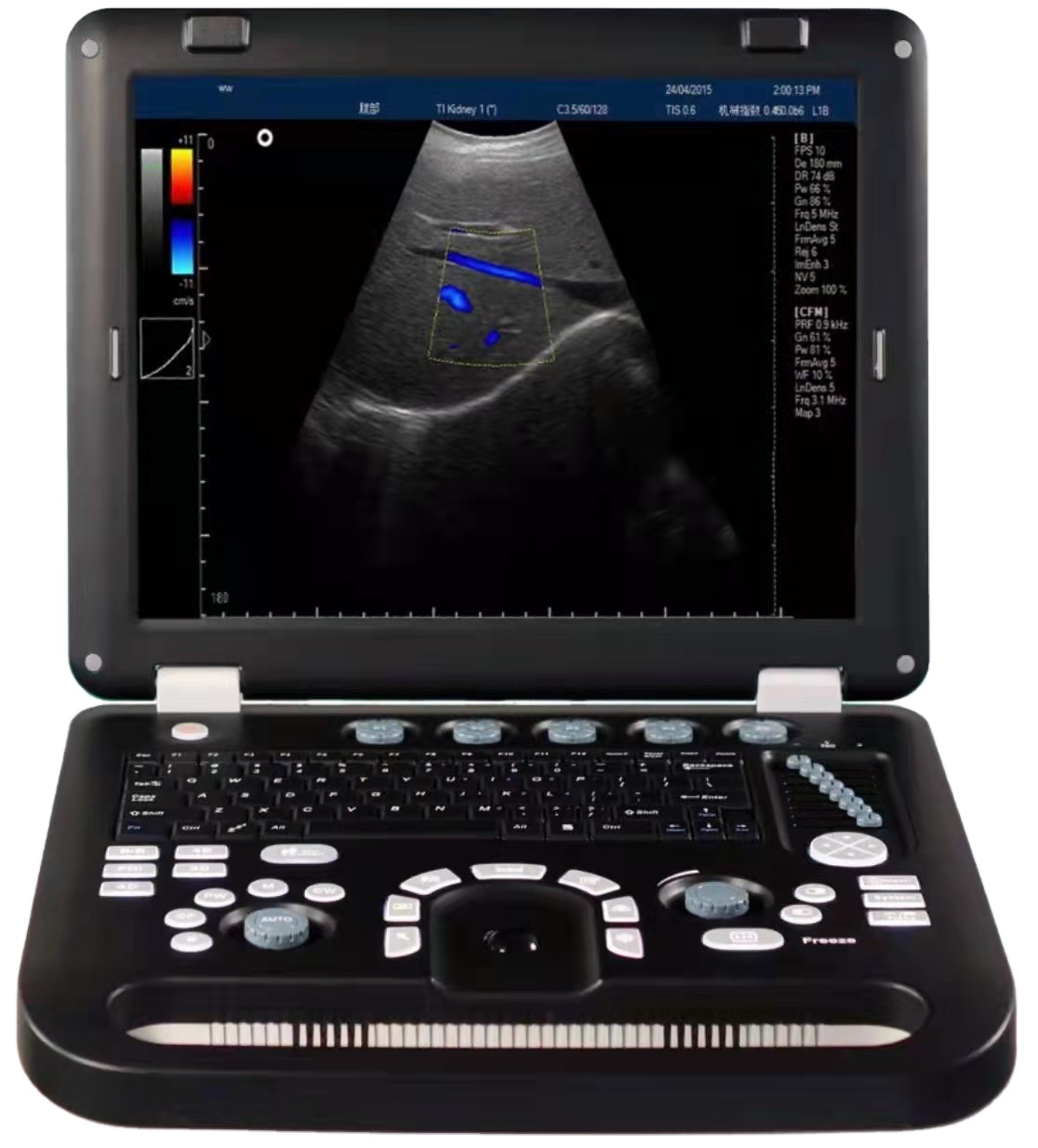 Amain OEM/ODM Manufacturers AM-50C 3D  color ultrasound diagnosis machine for Cardiac and fetal fetus doppler