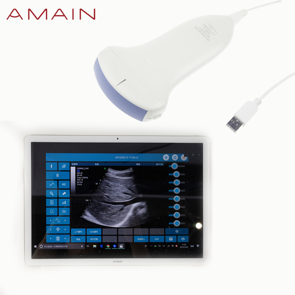 Amain MagiQ 2C HD Convex Handheld Medical echo ultrasound cardiac