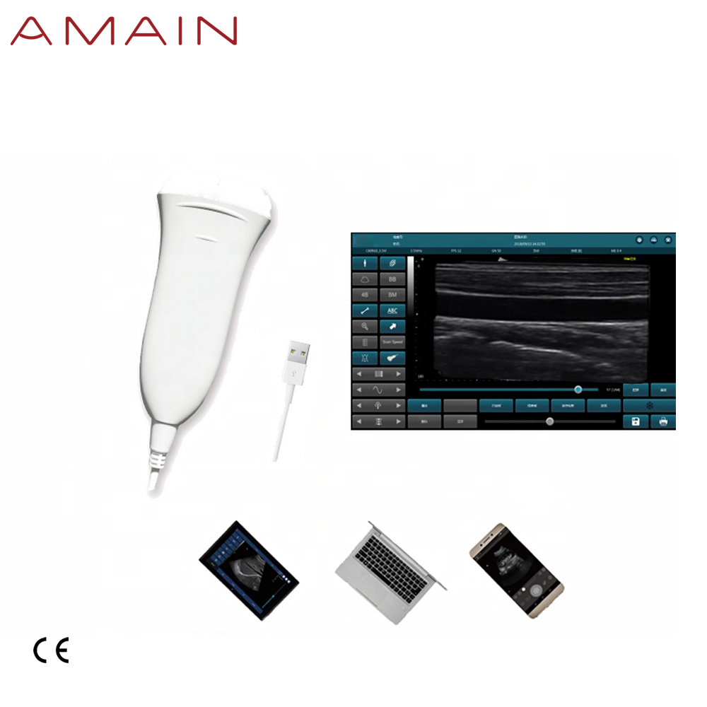 Amain MagiQ 2L HD लिनियर हँडहेल्ड मेडिकल अल्ट्रासाऊंड सिस्टम