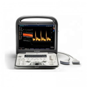 Ultrazvok srca in transvaginalni prenosni računalnik SonoScape S6