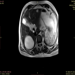 Магниттік-резонансты бейнелеу жабдығы AMMRI13, Медсинглонг