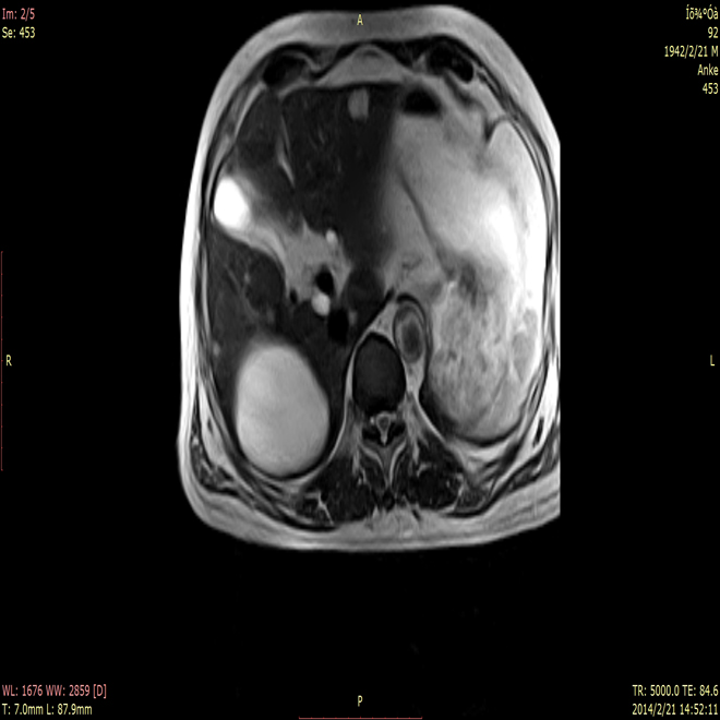 Equip d'imatge per ressonància magnètica AMMRI13 de Medsinglong (1)
