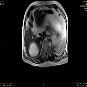 ਮੈਡਸਿੰਗਲੌਂਗ ਦੁਆਰਾ ਮੈਗਨੈਟਿਕ ਰੈਜ਼ੋਨੈਂਸ ਇਮੇਜਿੰਗ ਉਪਕਰਣ AMMRI13
