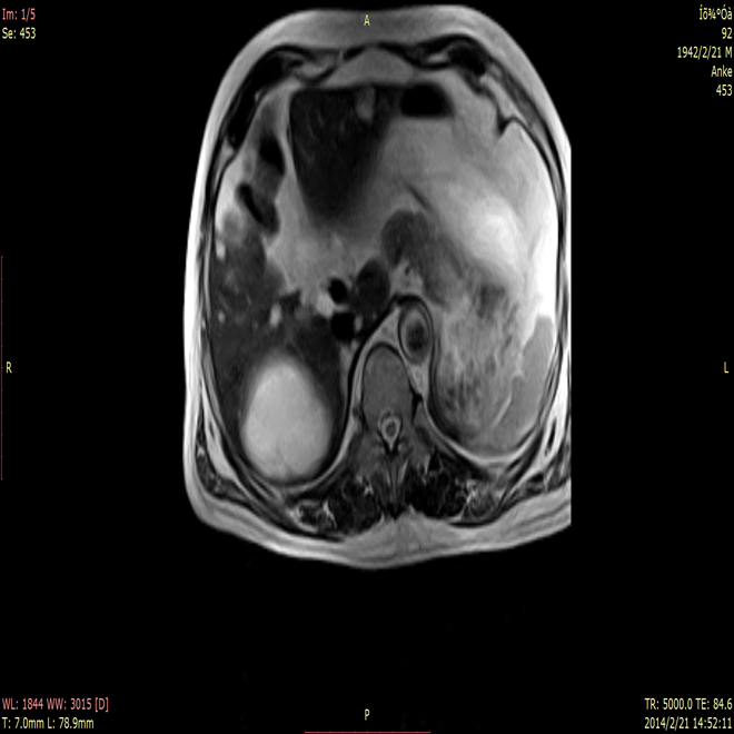 Medsinglong tərəfindən Maqnit Rezonans Görüntüleme Avadanlığı AMMRI13 (3)