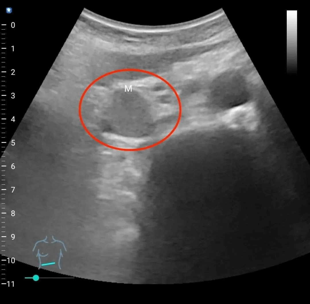 ادترف (5)