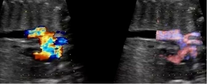 How to adjust the instrument during ultrasound examination (with step-by-step explanation– Part 1)