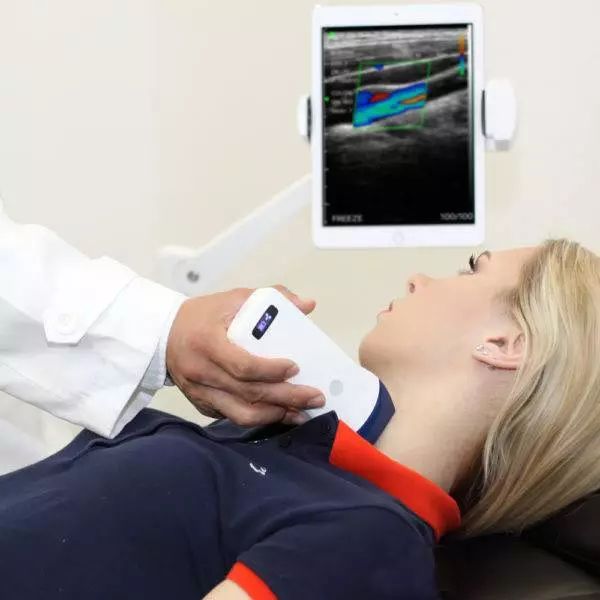 ultrazvuk 2