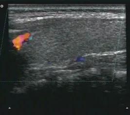 ultrasound 6