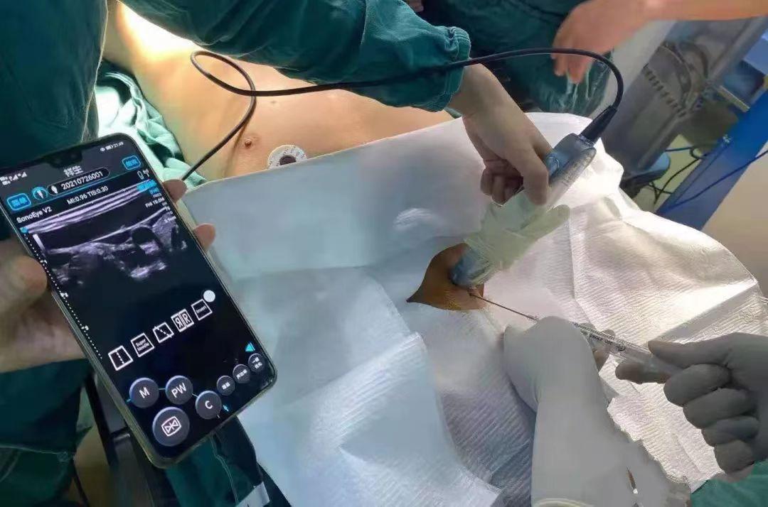 An Anesthesiologist’s GPS | Application of handheld ultrasound in anesthesia