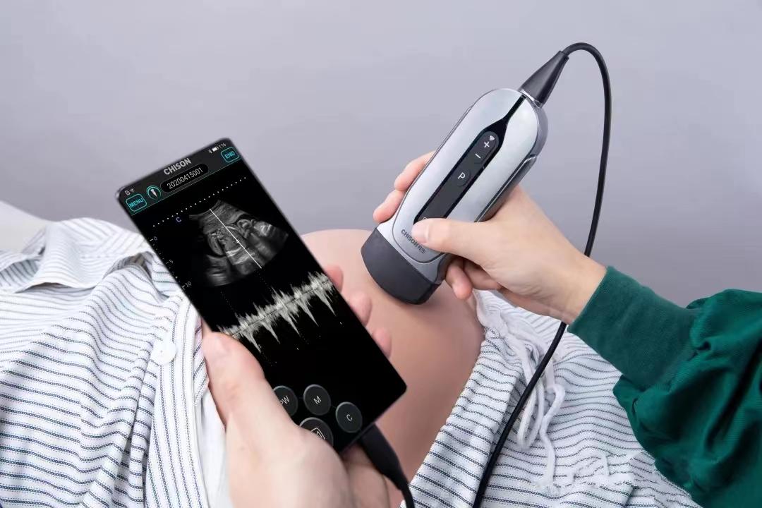 Care for mother and infant, protect the newborn | Application of handheld ultrasound in obstetrics